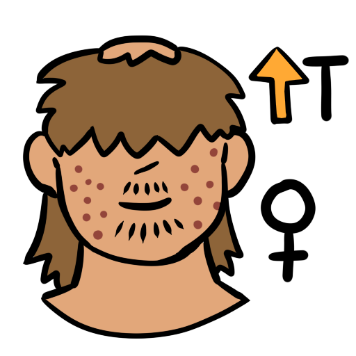 a person with light skin tone. They have acne, facial hair, and a bald spot on the top of their head. They have light brown hair. In the upper left of the image is an orange up arrow next to the letter T. In the bottom left is a female symbol.